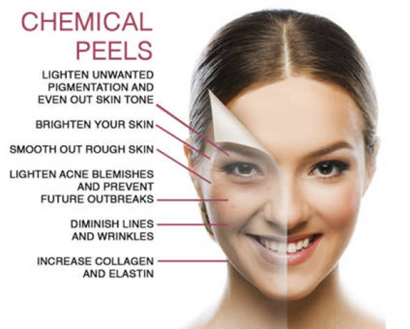 Wiltshire Inch Loss Clinic Chemical Peels